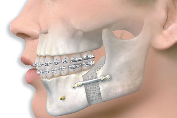 Çene ve Diş Cerrahisi